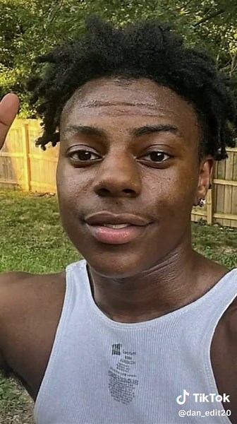 What Happened to IShowSpeed? Eye Incident Explained