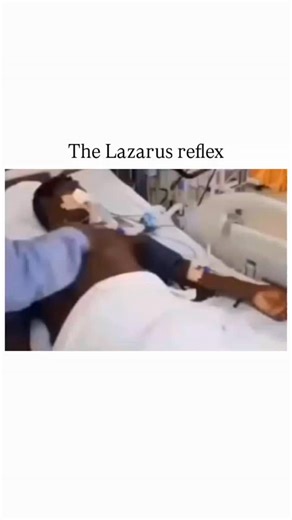 Science | The Lazarus reflex is a rare and eerie phenomenon where a brain-dead person suddenly raises their arms and crosses them over the chest —... | Instagram