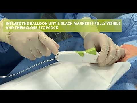 How to use MYNX CONTROL™ Vascular Closure Device