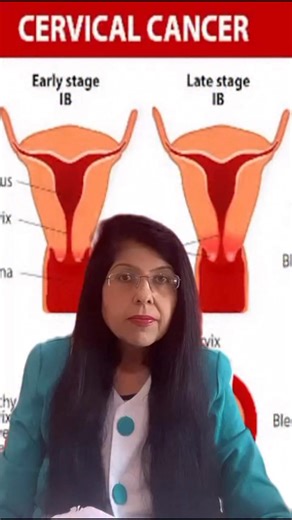 Dr Ritu Santwani on Instagram: "🎗️ 𝐉𝐚𝐧𝐮𝐚𝐫𝐲: 𝐂𝐞𝐫𝐯𝐢𝐜𝐚𝐥 𝐂𝐚𝐧𝐜𝐞𝐫 𝐀𝐰𝐚𝐫𝐞𝐧𝐞𝐬𝐬 𝐌𝐨𝐧𝐭𝐡 Most cervical cancers are preventable. Timely screening and vaccination can make the difference. 𝐘𝐨𝐮𝐫 𝐡𝐞𝐚𝐥𝐭𝐡 𝐝𝐞𝐬𝐞𝐫𝐯𝐞𝐬 𝐩𝐫𝐢𝐨𝐫𝐢𝐭𝐲 Cervical cancer is one of the most preventable cancers in women. ✔️ Caused mainly by persistent HPV infection ✔️ HPV vaccination can prevent up to 90% of cases ✔️ Pap smear & HPV testing detect precancerous changes early 𝐄𝐚𝐫𝐥𝐲 𝐝�