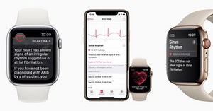 Mayo Clinic sees big success with AI detecting weak heart pumps via ECGs, could work with Apple Watch in the future - 9to5Mac