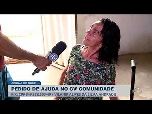 CV Comunidade: mulher perde as duas pernas após grave acidente