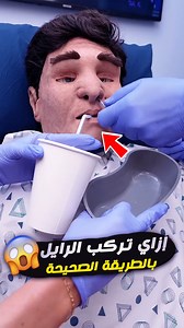 خطوات تركيب أنبوبة المعدة - NG Tube – Safe Insertion Step by Step #NGTube #NasogastricTube #تركيب_انبوب_المعدة #تمريض #NursingSkills #عناية_مركزة #ICU #MedicalEducation #PatientCare #CriticalCare Nasogastric Tube insertion, NG Tube nursing skill, تركيب انبوب المعدة, شرح NG Tube بالعربي, كيفية تركيب Nasogastric Tube, اخطاء تركيب NG Tube, nursing ICU training, NG Tube complications, confirm NG Tube placement, كيفية التأكد من مكان الانبوبة, تمريض العناية المركزة NG Tube, mechanical feeding tube, me