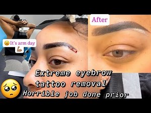 Microblading procedure with Saline Removal process #mircoblading #tattooremoval #eyebrows