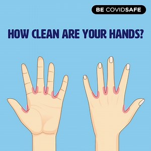 34K views · 272 reactions | The fingertips, backs of the thumbs and...