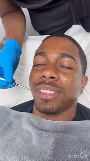 1.9K views | Chemical peels offer several benefits for the skin. Here...