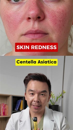 Best skincare ingredients for your skin concern
