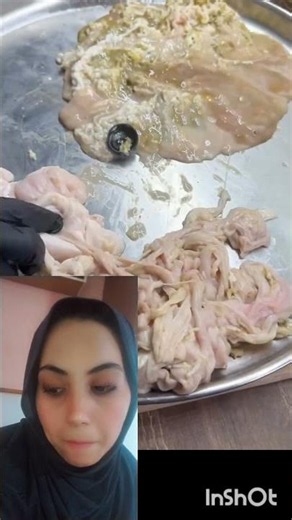 أسهل طريقة تنضيف مسارن حولي غير بي غلاق موناضة