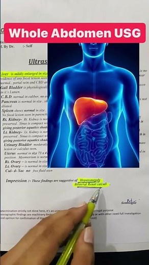 #whole abdominal ucg,usg whole abdomen,whole abdominal ultrasound procedure#ecgliver,usg liver,usg