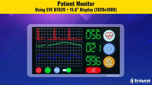 📊 Bridgetek BT820B Embedded Video Engine Demo This demo showcases advanced GUI functions for bedside patient monitoring — including Vital Signs Display, Waveform Visualization, and Touchscreen Controls. With the RP2040 MCU and BT820B GPU, it delivers smooth graph rendering, real-time updates, and responsive user interfaces. 🔧 Technical Highlights: - 15.6” LCD (1920x1080) - Raspberry Pi RP2040 MCU - Bridgetek BT820B GPU - Capacitive touchscreen 🌍 Applications extend beyond healthcare to Indust