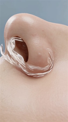 Nasal Surgery Explained 🩺 | 3D Medical Animation #shorts