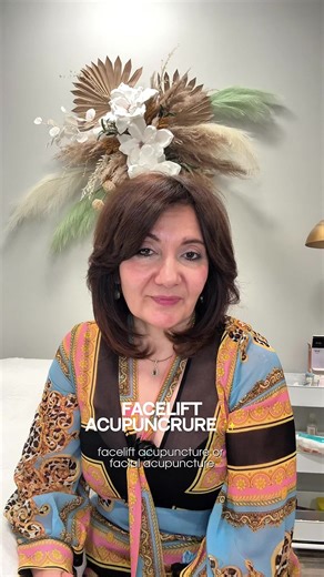 Facelift Acupuncture is a gentle, natural way to lift and refresh your face. It works beautifully for women from their 30s to 60s, helping the skin stay firm, bright, and smooth without injections or downtime. ##FaceliftAcupuncture #HolisticBeauty #NaturalLift #CollagenBoost #FibroblastActivation prevention. In your 40s and 50s it lifts, tones, and brings back glow. After 60 it softens lines and restores natural radiance. Perfect for anyone who wants a fresh, healthy look in a natural way.