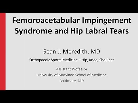 Femoroacetabular Impingement Syndrome and Hip Labral Tears