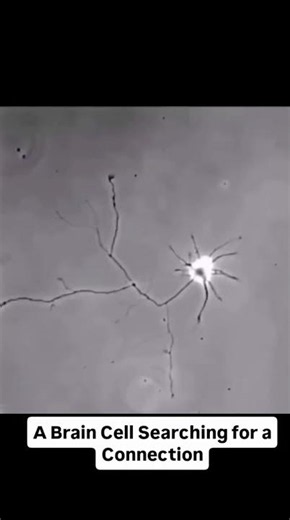 A Brain Cell Searching for a Connection
