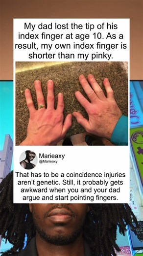 My dad lost the tip of his index finger at age 10. As a result, my own index