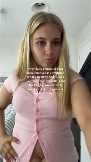 Embracing Body Positivity: Understanding Stretch Marks