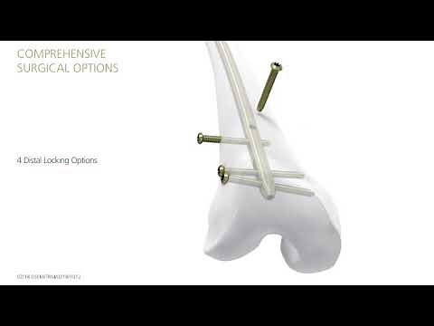 Femoral Recon Nail - DePuySynthes