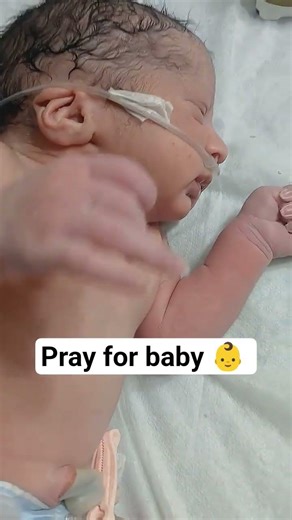 pray for baby #trending #shortvideo #shorts #laboratory #cute #baby #nicu #trend #shorts #shortvideo