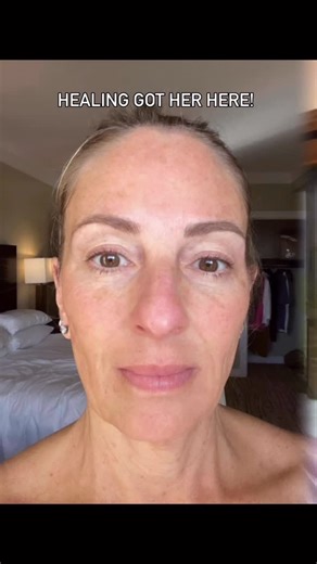 Malia Hana on Instagram: "An injectable free glow up at 57. Yes!🙌🏼 She’s a graduate of my Heal Complete & @breakupwithinjectables courses -> Heal Age Well bundle. Before she started her healing journey with me, she had spent thousands on numerous harsh & toxic treatments.💸💰💉♨️🔬 Facts: She was left with extreme loss of collagen, laxity, asymmetry & well, you see her day 1 pic. As a post menopausal woman she was told she could never build collagen naturally, lift, tighten, or define without�