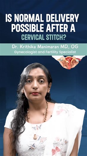 Krithika Manimaran on Instagram: "Here are the types of cervical stitch (cerclage) used in pregnancy 1. McDonald Cerclage Most common type A purse-string stitch placed around the cervix Easy to put and remove Usually done at 12–14 weeks Removed around 37 weeks or at labor 2. Shirodkar Cerclage Stitch placed higher up near the internal os Cervical mucosa is dissected before placing stitch More secure, technically harder Removal may be difficult; sometimes left for C-section 3. Transabdominal Cerc