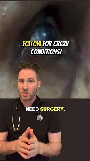 12K views · 157 reactions | Pulsatile exophthalmos, a.k.a. pulsatile proptosis, is a clinical symptom characterized by protrusion - i.e. exophthalmos (proptosis) - and pulsation of the eyeball that can occur due to various causes: caroticocavernous fistulas. neurofibromatosis type 1 (with sphenoid wing dysplasia) 2. arteriovenous malformation. #eyeproblem #doctor | Doctor Joe | Facebook