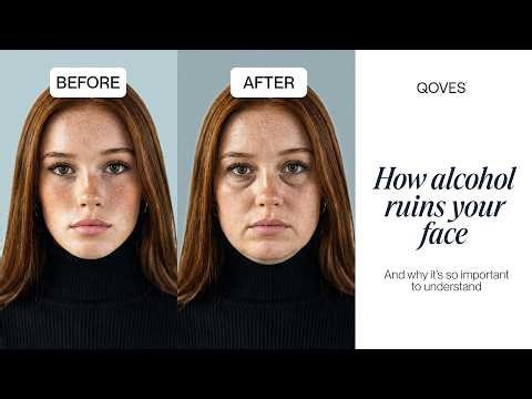 How Alcohol RUINS Your Face!