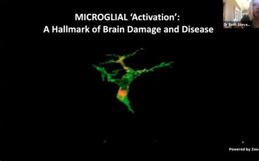 Microglia function and dysfunction in Alzheimer’s disease │Dr Beth Stevens