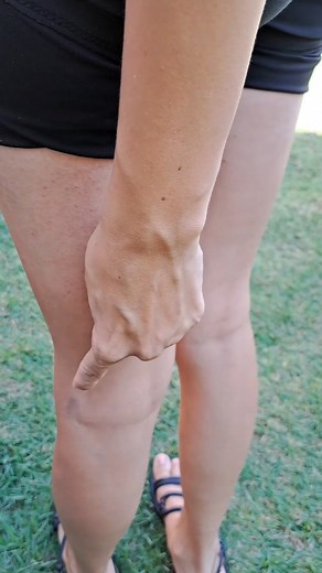 1.6M views · 18K reactions | Skin care and varicose vein care | My Tips Book | Facebook