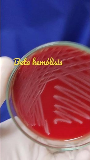 Beta hemólisis en Agar Sangre