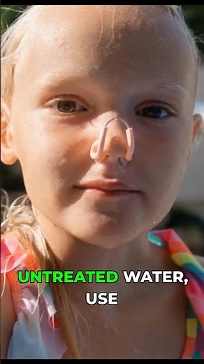 Protect Yourself: Stop Brain-Eating Amoeba Infection!