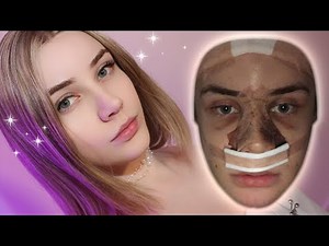 plastic surgery update and *face reveal* after 3.5 years!