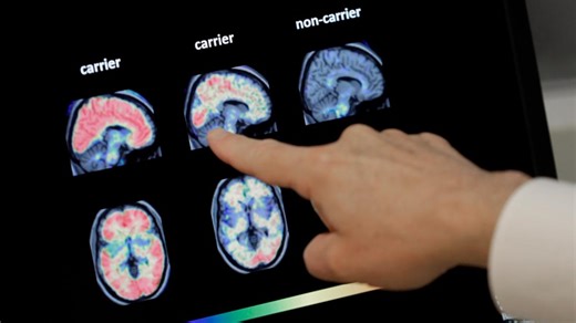 Up to 4 in 10 people could develop dementia after 55. What you can do to lower your risk