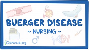 Buerger disease: Nursing: Video & Causes | Osmosis