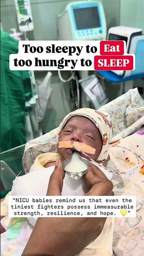 Preterm baby’s in nicu journey- Dr.Santosh Yadav