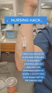 8K views · 752 reactions | Nursing HACK!! Stay tuned’ ✨‍⚕️ #nurse #nursing #nurses | Nurses Edge | Facebook