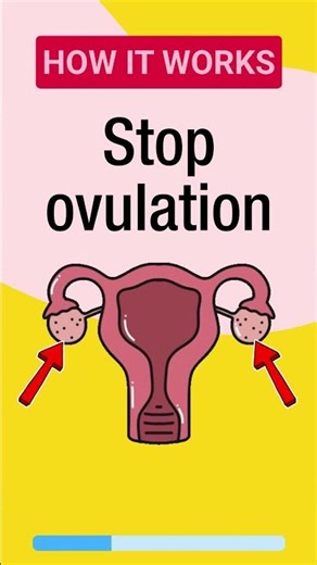 How does the contraceptive injection work? #contraception #injection #shorts