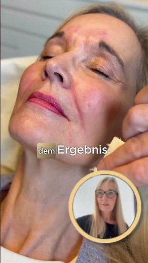 ✨ Four days later – a result that inspires! ✨