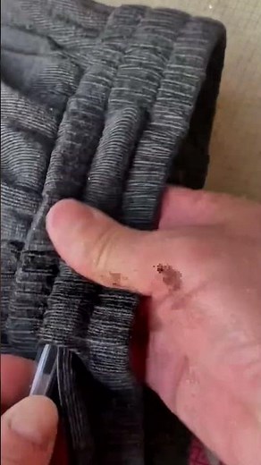 Easy Way to Reinsert a Loose Drawstring in Seconds
