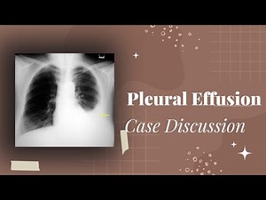 Case Discussion || Pleural Effusion
