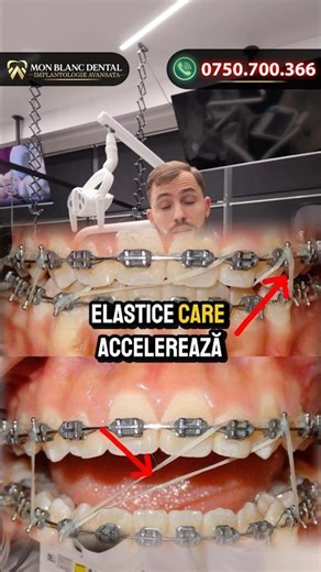 4 GREȘELI în Ortodonție