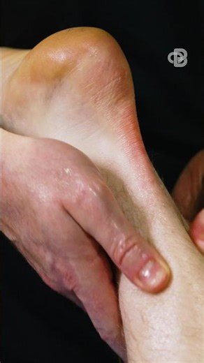Achilles Pain