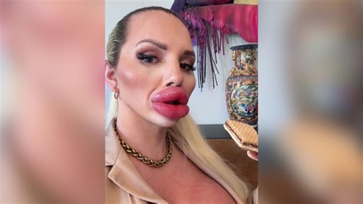 Quién es Andrea Ivanova, la mujer que vive en Mallorca y asegura tener los labios más grandes del mundo