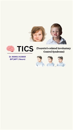 Dr. Manoj Kumar (PT) || MPT {NEURO} on Instagram: "TICS 🧠 | Sudden, Repetitive & Partially Suppressible Movements Tics are rapid, recurrent, non-rhythmic motor movements or vocalizations, often preceded by an urge and temporarily suppressible. 🔍 Key clinical features: • Brief & repetitive movements/sounds • Increase with stress, fatigue & anxiety ⚡ • Reduce during sleep or focused activity • Premonitory sensory urge present 🧠 Neuro insight: Cortico-striato-thalamo-cortical (CSTC) circuit dysf