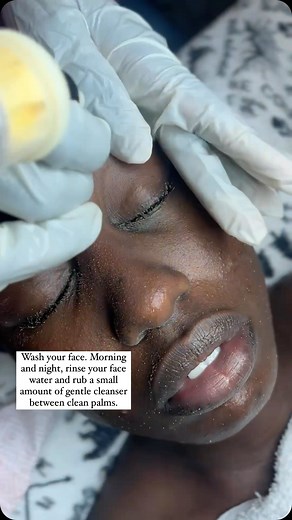 271K views · 1.7K reactions | This reduces acne by decreasing the...