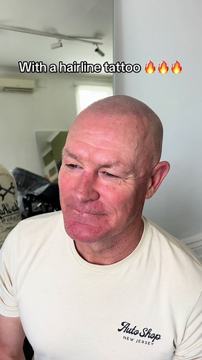 Melbourne's Hair Tattoo Experts - Inkd SMP Melbourne Scalp Micropigmentation