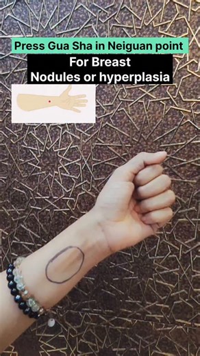 Neha Gupta on Instagram: "#pressguashainneiguanpoint #viral #yoga #Here are the benefits of pressing or using Gua Sha on the Neiguan point (PC6) for breast nodules or hyperplasia: 🌿 Neiguan Point (PC6) Location: Found on the inner side of the forearm, about three finger-widths below the wrist crease, between the two tendons (palmaris longus and flexor carpi radialis). 💠 Benefits of Pressing / Gua Sha on Neiguan Point for Breast Nodules or Hyperplasia: Regulates Hormonal Balance: Stimulating Ne