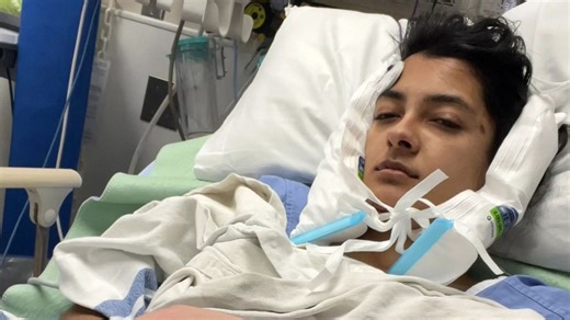 A gobstopper sweet snapped my jaw in TWO places leaving me in hospital