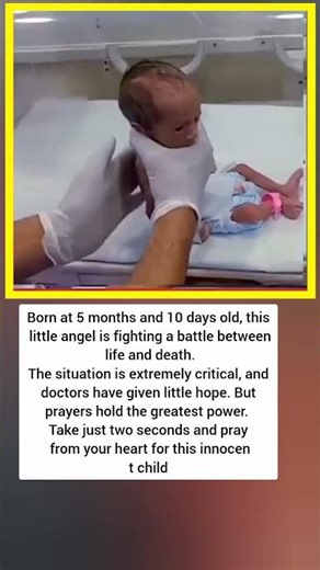 Born at 5 months and 10 days old, this#shorts #shortvideo #short #song #subscribe ❤️