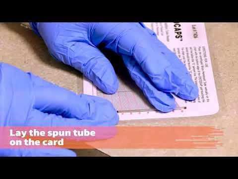 Perform Preventive Maintenance for the Microhematocrit Centrifuge