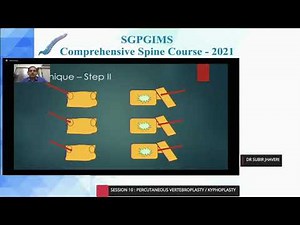 Vertebroplasty & Kyphoplasty, Step by Step Technique, Dr Subir N Jhaveri, Consultant Spine Surgeon